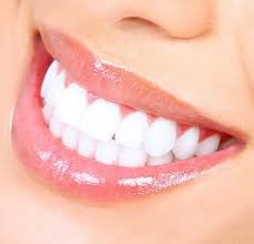 Periodontitis