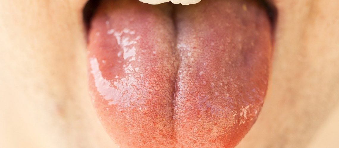 dry mouth